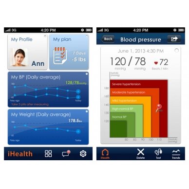 iHEALTH BP5 Kraujo spaudimo matuoklis iHealth BP5 2