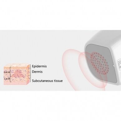 Mini HIFU fokusuotas ultragarsinis RF kūno ir veido aparatas MALENA 3