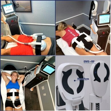 RENASCULPT+RF+EMS body shaping machine (5 tips) 4